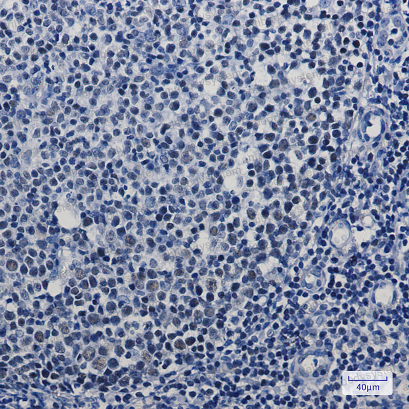 Валидация AntibodySystem RHJ72101