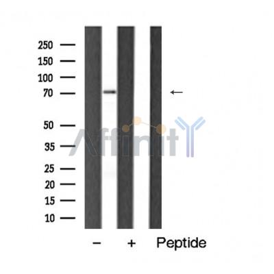 Валидация Affinity AF5474 - 3140