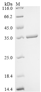 SDS-PAGE
