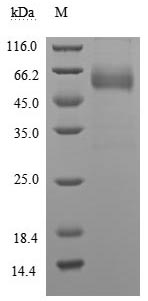 SDS-PAGE