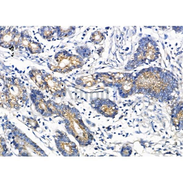 Валидация Affinity DF8315 - 20168