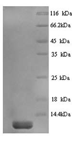 SDS-PAGE