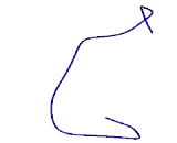 Chemokine Like Factor Superfamily 7 (CKLFSF7) Chemokine Like Factor Superfamily 7 (CKLFSF7)