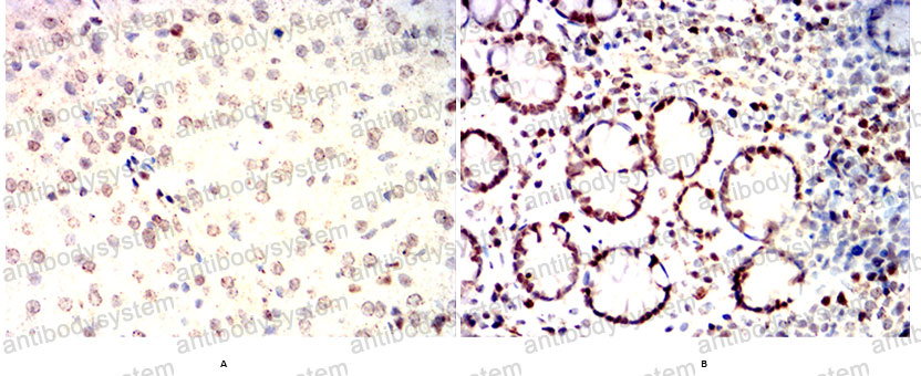 Валидация AntibodySystem RHC91302