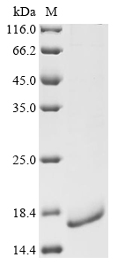 SDS-PAGE