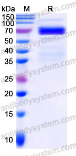 EHC05102, SDS-PAGE