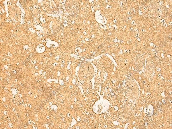 Иммуногистохимия, RNASE4, ткань мозга человека