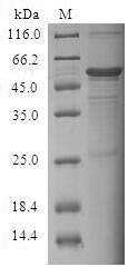 SDS-PAGE