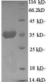 SDS-PAGE