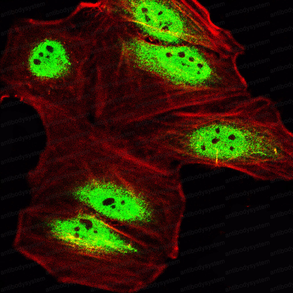 Валидация IF - AntibodySystem RHH16301