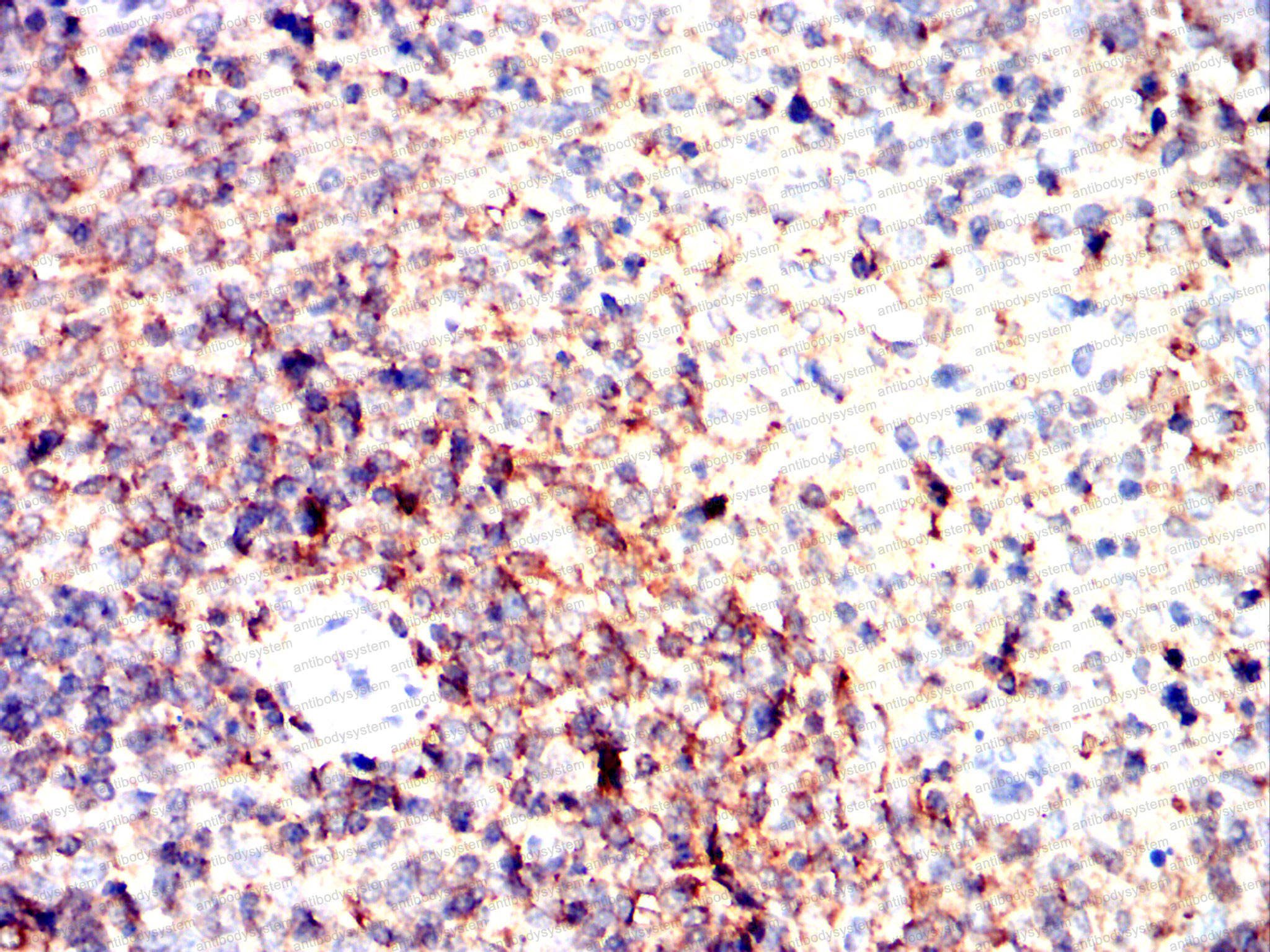 Валидация AntibodySystem RHE03401