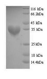 SDS-PAGE