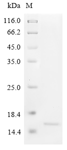 SDS-PAGE