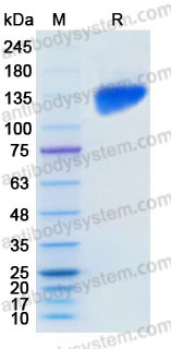 AHD38504, SDS-PAGE