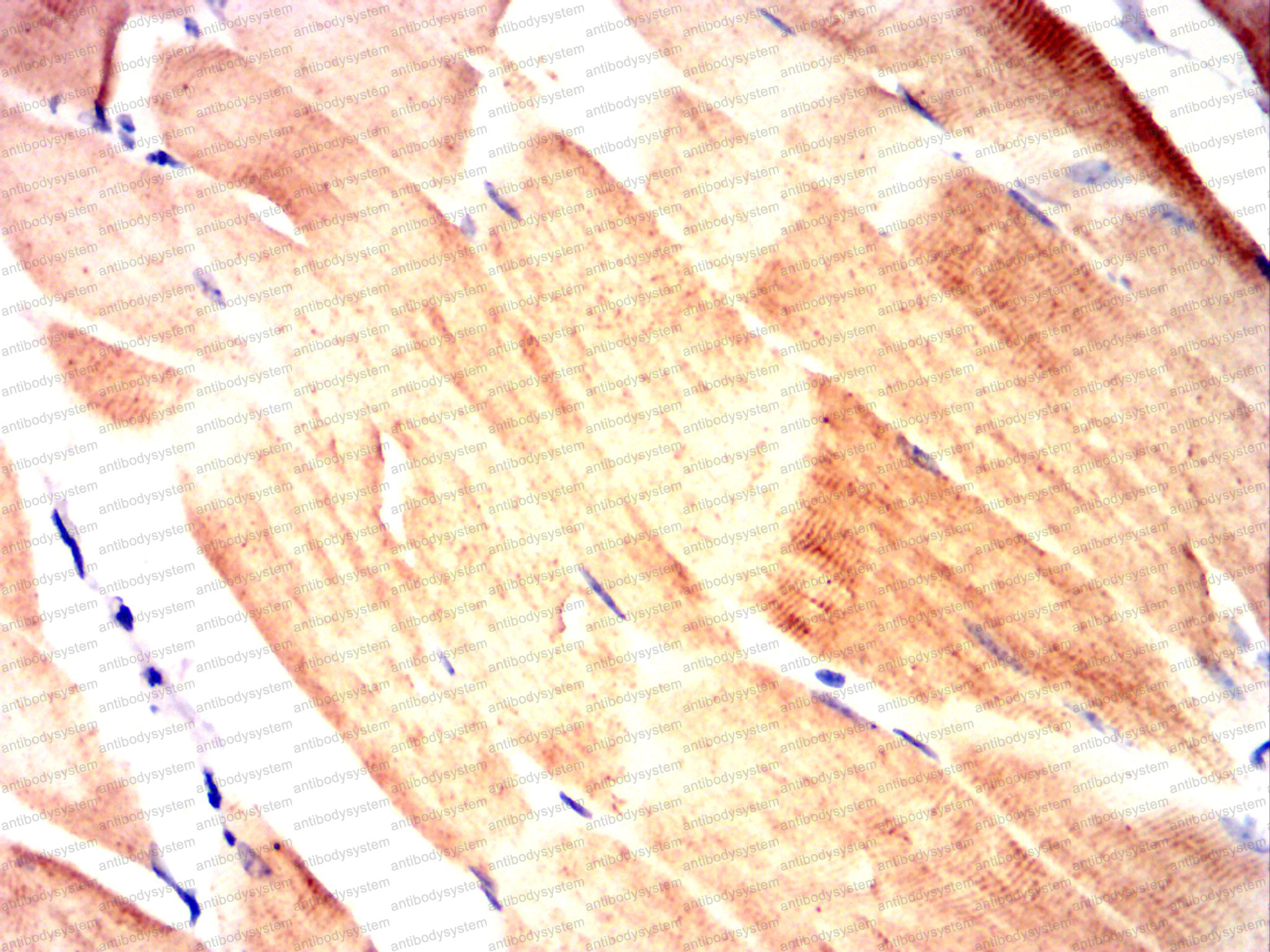 Валидация AntibodySystem RHJ82304 (3559)