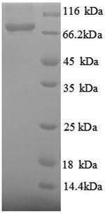 SDS-PAGE