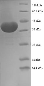 SDS-PAGE