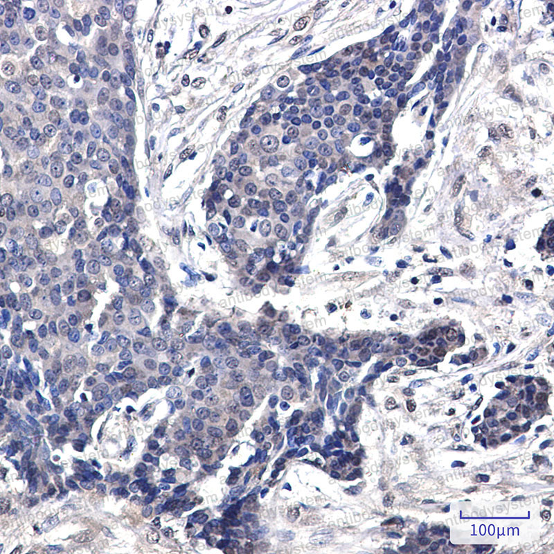 Валидация AntibodySystem RHG62701 (3031)