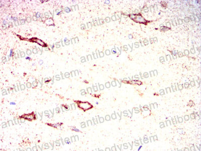 Валидация AntibodySystem RHG06501 (2822)