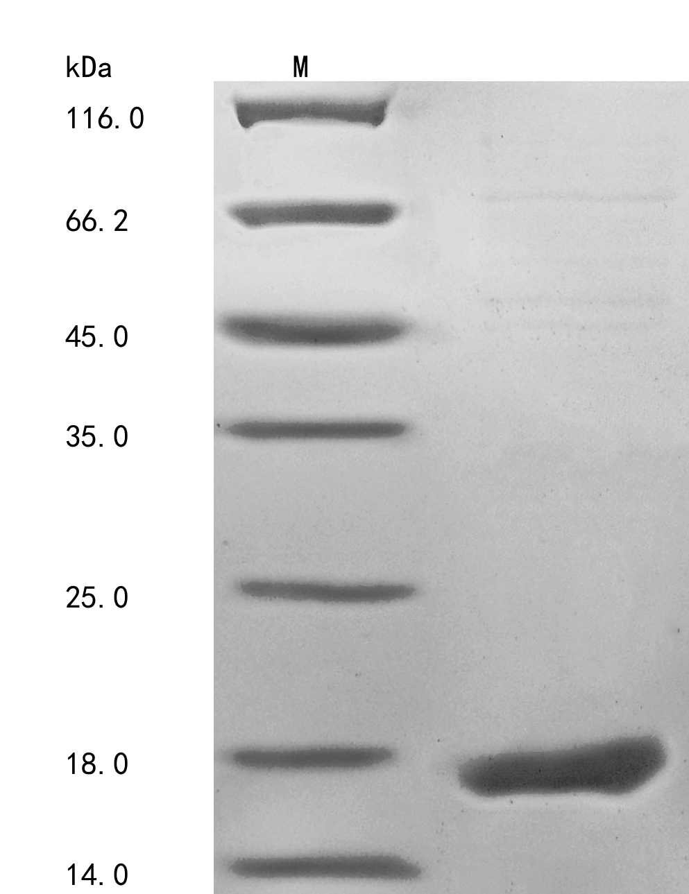 SDS-PAGE