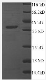 SDS-PAGE