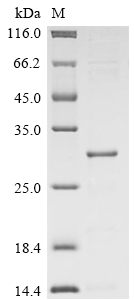 SDS-PAGE