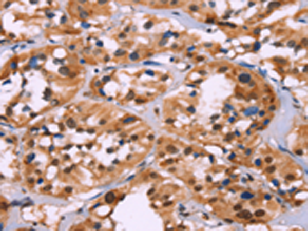 Валидация AssayVector ARM1644(1791)