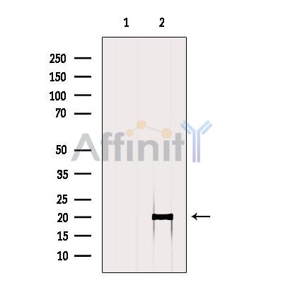 Валидация Affinity AF6017 - 3205