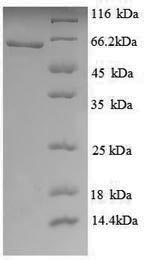 SDS-PAGE