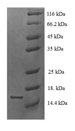 SDS-PAGE