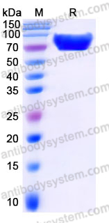 AHJ14804, SDS-PAGE