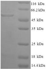 SDS-PAGE