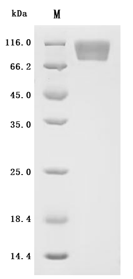 SDS-PAGE