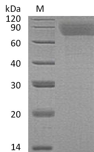 SDS-PAGE