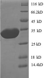 SDS-PAGE