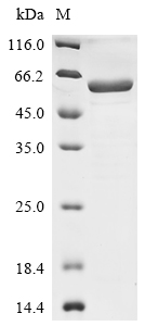 SDS-PAGE
