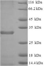 SDS-PAGE