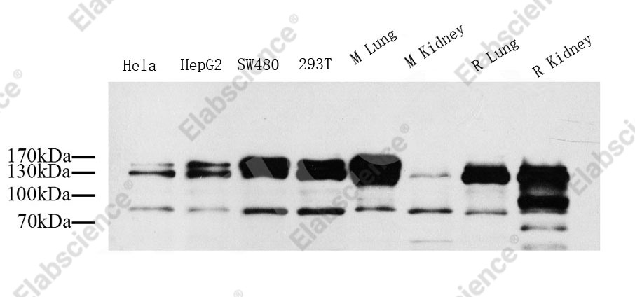 Вестерн-блоттинг, CD31, различные образцы