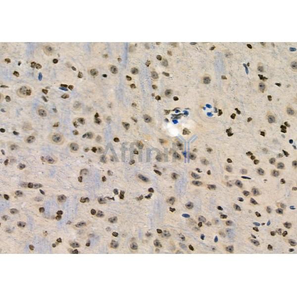 Валидация Affinity DF6062 - 17274