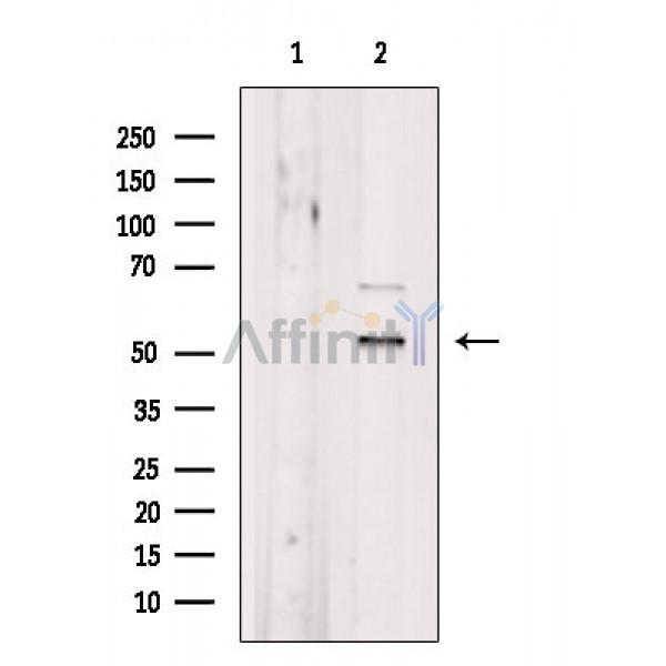 Валидация Affinity DF4540 - 16123