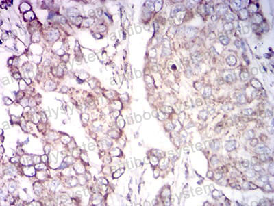 Валидация AntibodySystem RHF80804