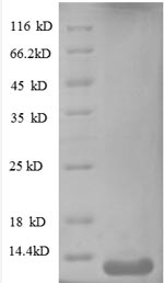 SDS-PAGE
