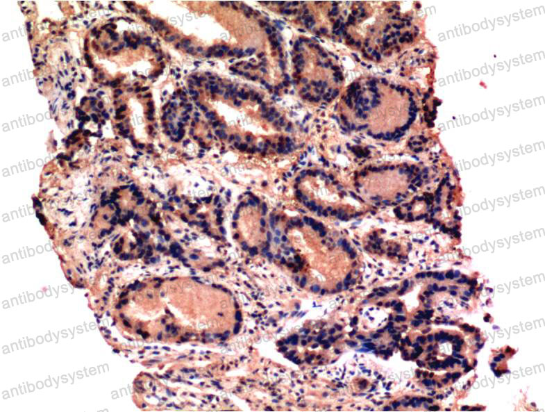 Валидация AntibodySystem RHE35911 (2115)