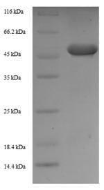 SDS-PAGE