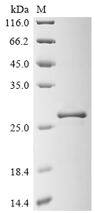 SDS-PAGE