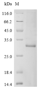SDS-PAGE