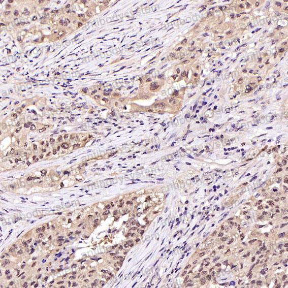 Валидация AntibodySystem RHC69301 (1057)