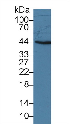 14010