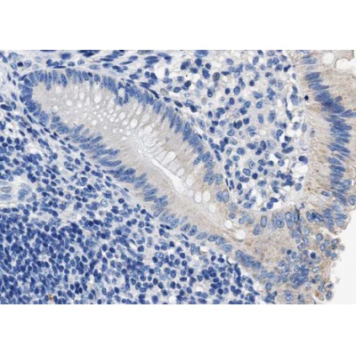 Валидация Affinity AF3488 - 2015