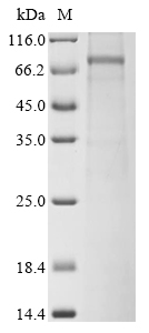 SDS-PAGE